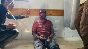 La agencia AP cuestiona los ataques israelíes a un hospital de Gaza que mataron a cinco periodistas