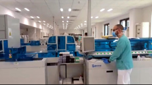 Organoidi di cervello usati per costruire biocomputer