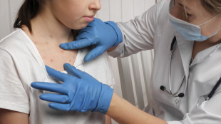 Morbillo, studio apre la porta a primo trattamento mirato