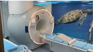 Tumore della prostata, nuovo protocollo evita le biopsie inutili