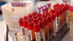 Per 9 italiani su 10 la scienza medica è motore sviluppo