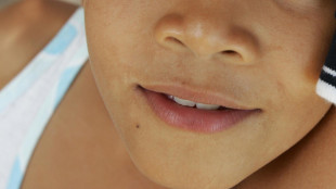 Metalli dannosi per i bambini, lo dicono i denti da latte