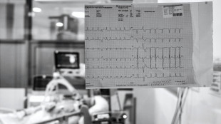 In arrivo piattaforma europea per garantire cure cardiovascolari in caso di crisi